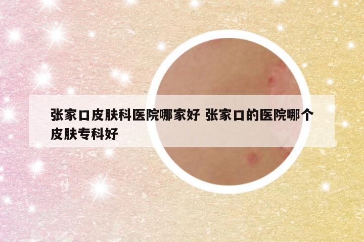 张家口皮肤科医院哪家好 张家口的医院哪个皮肤专科好