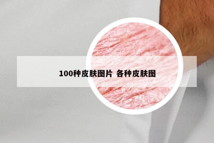 100种皮肤图片 各种皮肤图