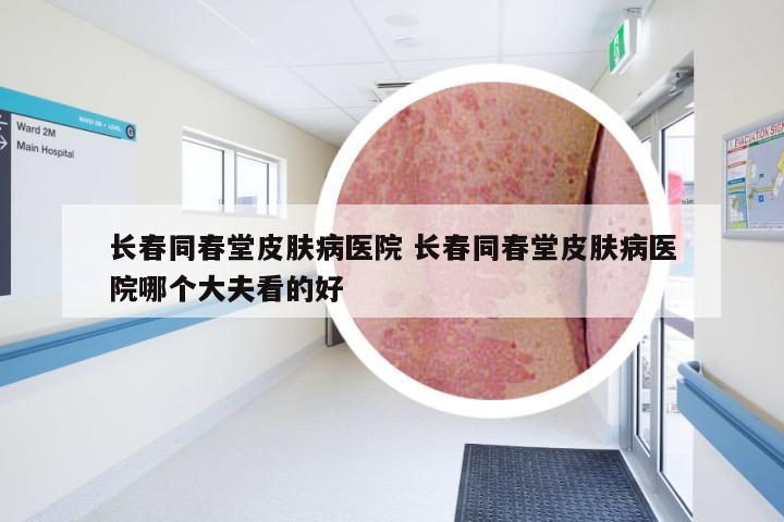 长春同春堂皮肤病医院 长春同春堂皮肤病医院哪个大夫看的好