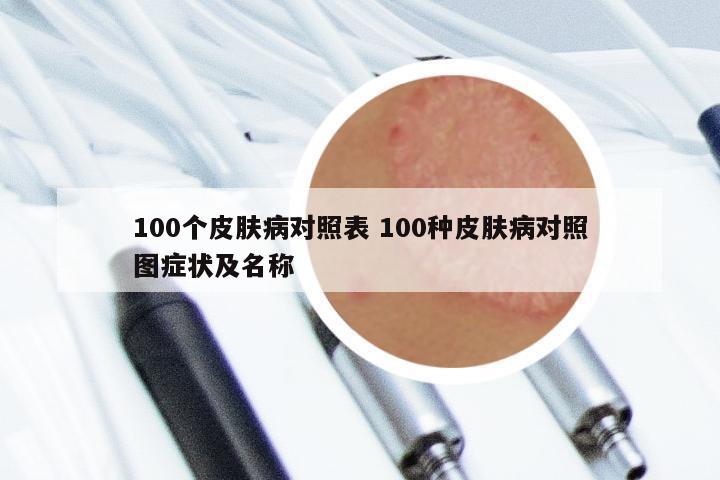 100个皮肤病对照表 100种皮肤病对照图症状及名称