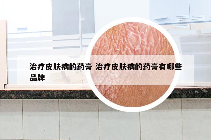 治疗皮肤病的药膏 治疗皮肤病的药膏有哪些品牌
