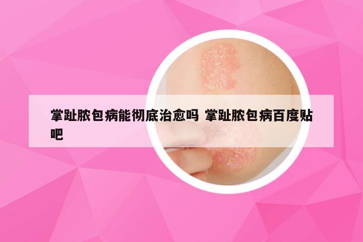 掌趾脓包病能彻底治愈吗 掌趾脓包病百度贴吧