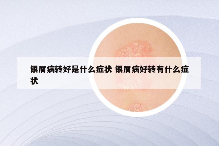 银屑病转好是什么症状 银屑病好转有什么症状