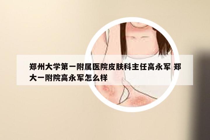 郑州大学第一附属医院皮肤科主任高永军 郑大一附院高永军怎么样