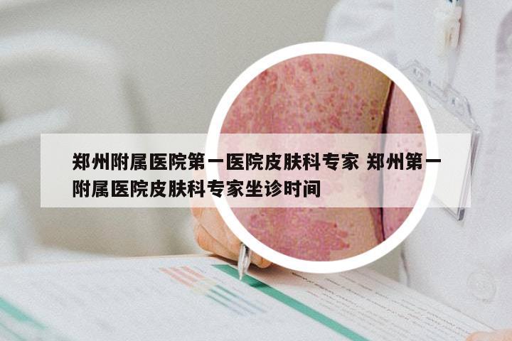 郑州附属医院第一医院皮肤科专家 郑州第一附属医院皮肤科专家坐诊时间
