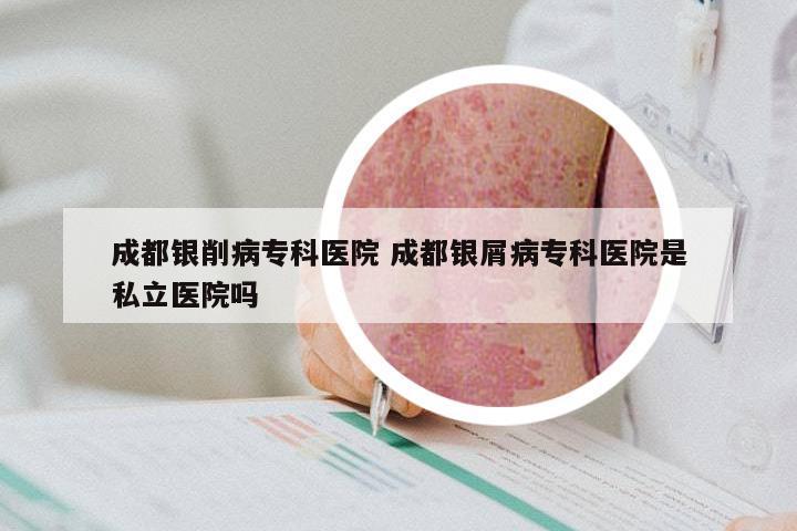 成都银削病专科医院 成都银屑病专科医院是私立医院吗