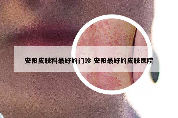 安阳皮肤科最好的门诊 安阳最好的皮肤医院