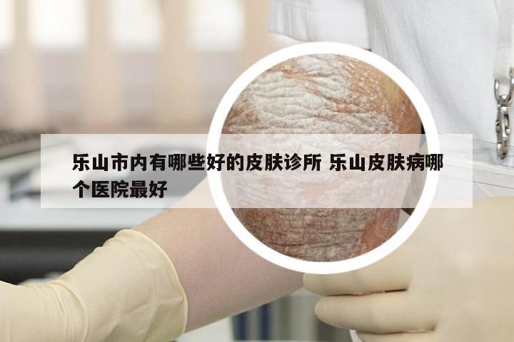 乐山市内有哪些好的皮肤诊所 乐山皮肤病哪个医院最好