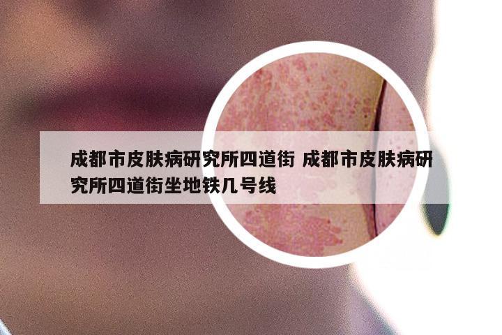 成都市皮肤病研究所四道街 成都市皮肤病研究所四道街坐地铁几号线