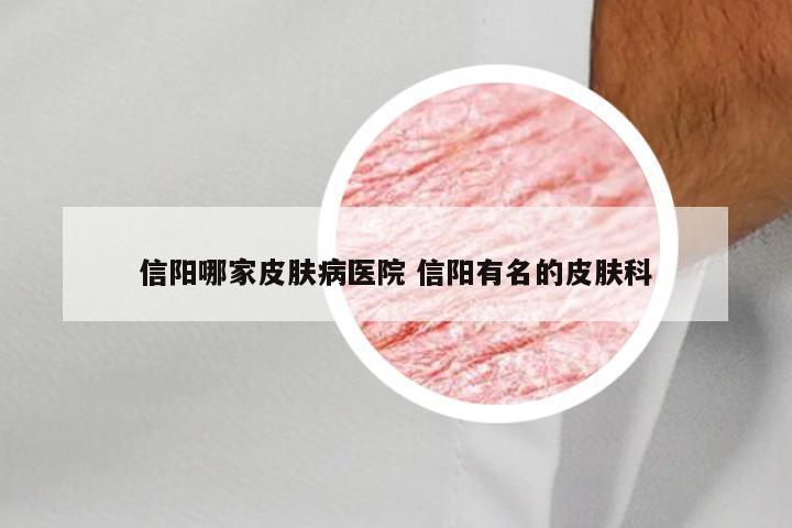 信阳哪家皮肤病医院 信阳有名的皮肤科