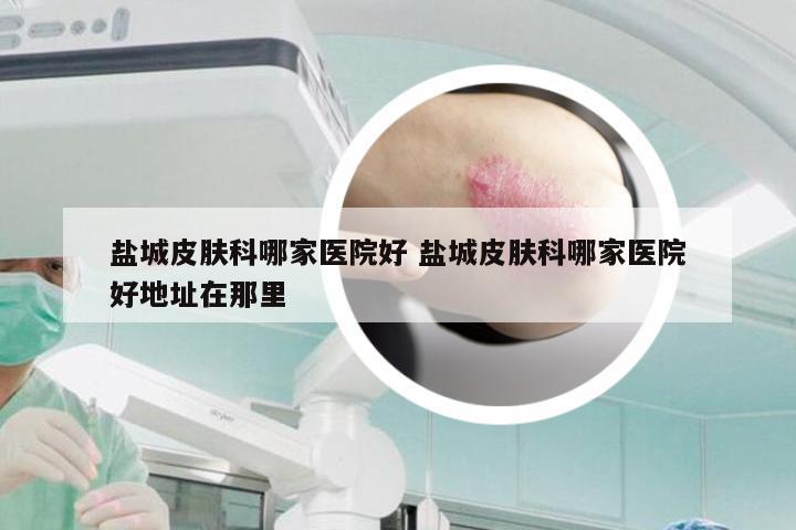 盐城皮肤科哪家医院好 盐城皮肤科哪家医院好地址在那里