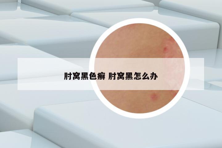 肘窝黑色癣 肘窝黑怎么办