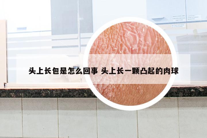 头上长包是怎么回事 头上长一颗凸起的肉球