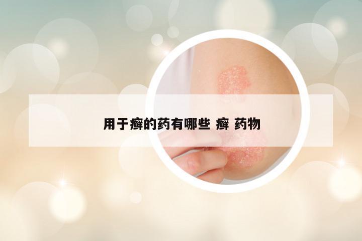 用于癣的药有哪些 癣 药物