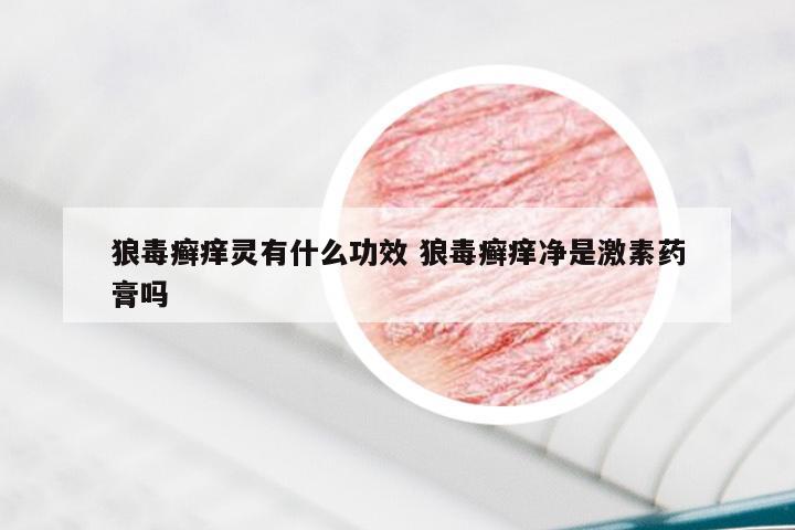 狼毒癣痒灵有什么功效 狼毒癣痒净是激素药膏吗