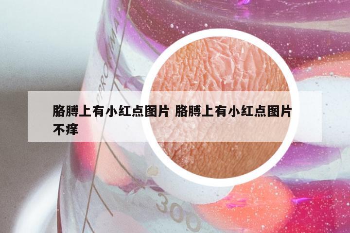 胳膊上有小红点图片 胳膊上有小红点图片 不痒