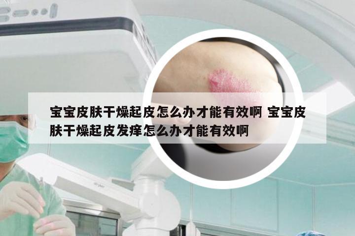 宝宝皮肤干燥起皮怎么办才能有效啊 宝宝皮肤干燥起皮发痒怎么办才能有效啊