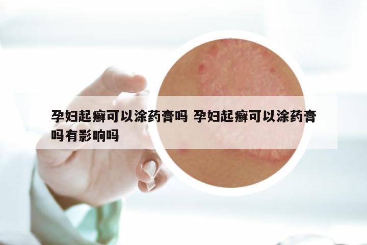 孕妇起癣可以涂药膏吗 孕妇起癣可以涂药膏吗有影响吗