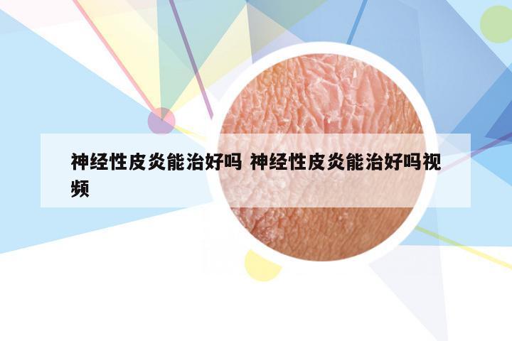 神经性皮炎能治好吗 神经性皮炎能治好吗视频