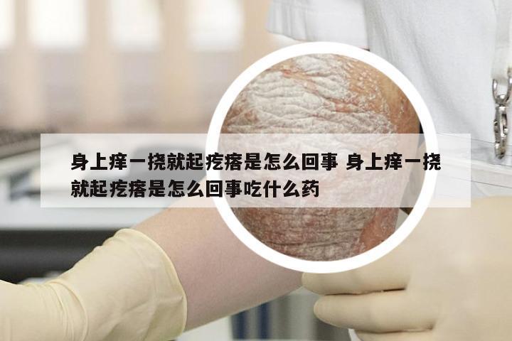 身上痒一挠就起疙瘩是怎么回事 身上痒一挠就起疙瘩是怎么回事吃什么药