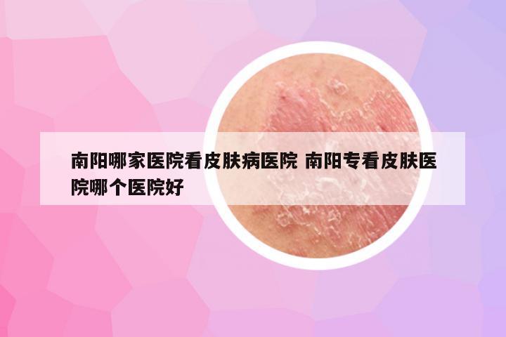 南阳哪家医院看皮肤病医院 南阳专看皮肤医院哪个医院好