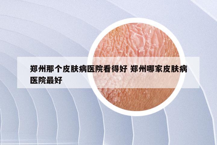 郑州那个皮肤病医院看得好 郑州哪家皮肤病医院最好