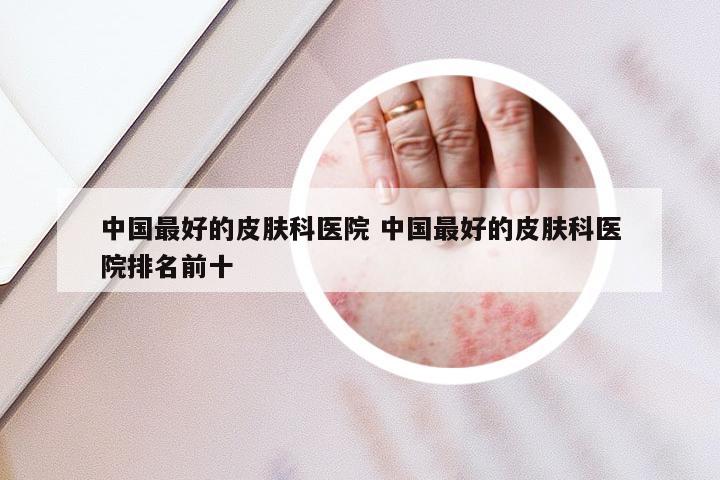 中国最好的皮肤科医院 中国最好的皮肤科医院排名前十