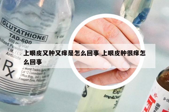 上眼皮又肿又痒是怎么回事 上眼皮肿很痒怎么回事