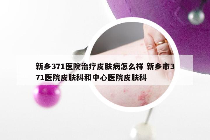 新乡371医院治疗皮肤病怎么样 新乡市371医院皮肤科和中心医院皮肤科