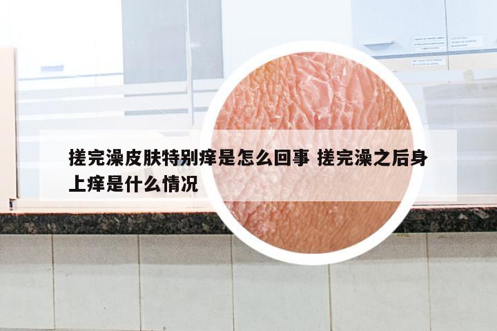 搓完澡皮肤特别痒是怎么回事 搓完澡之后身上痒是什么情况