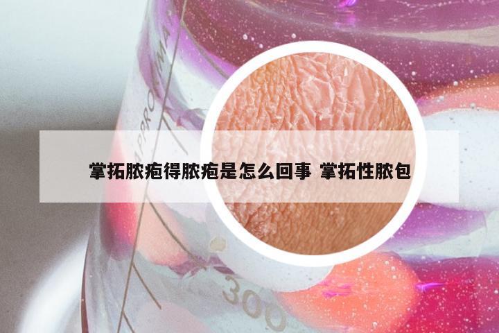 掌拓脓疱得脓疱是怎么回事 掌拓性脓包