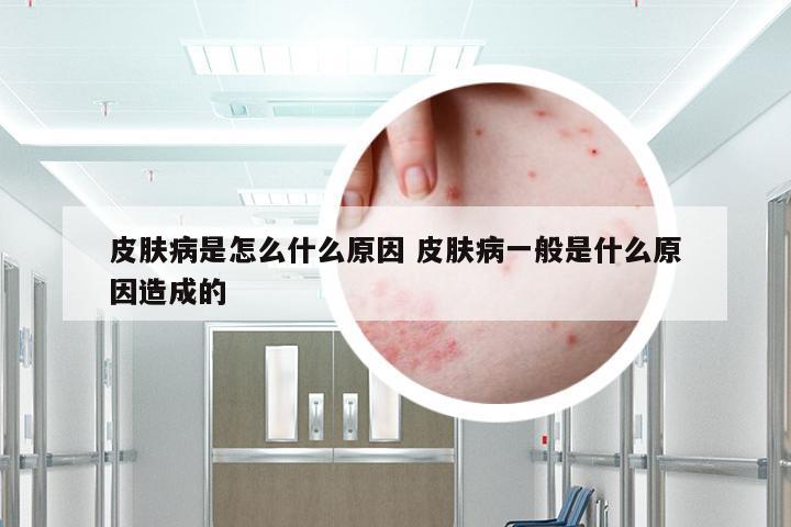 皮肤病是怎么什么原因 皮肤病一般是什么原因造成的