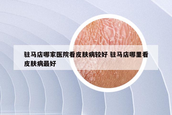 驻马店哪家医院看皮肤病较好 驻马店哪里看皮肤病最好