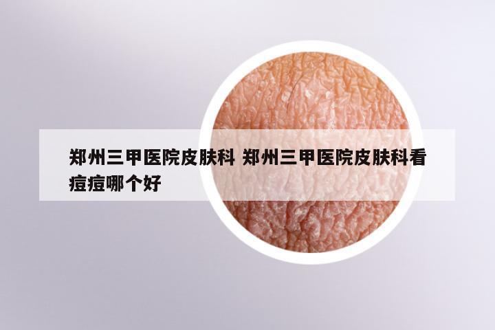 郑州三甲医院皮肤科 郑州三甲医院皮肤科看痘痘哪个好