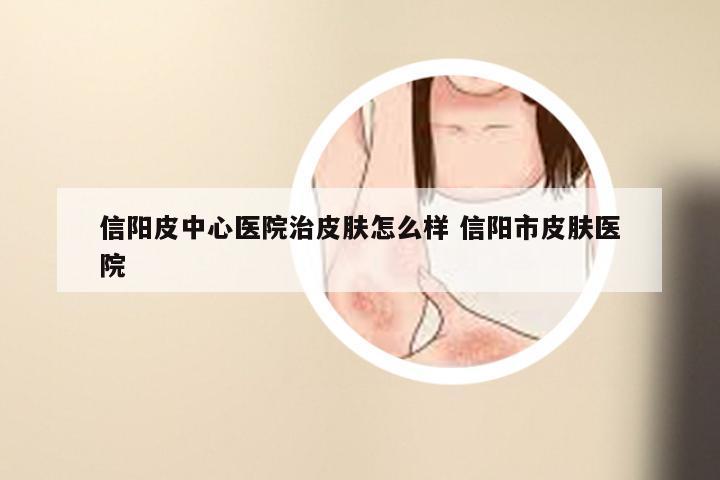 信阳皮中心医院治皮肤怎么样 信阳市皮肤医院