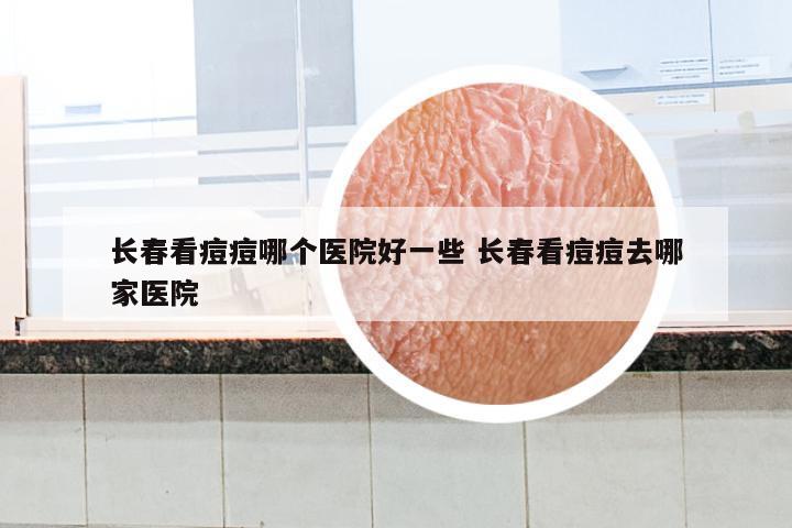 长春看痘痘哪个医院好一些 长春看痘痘去哪家医院