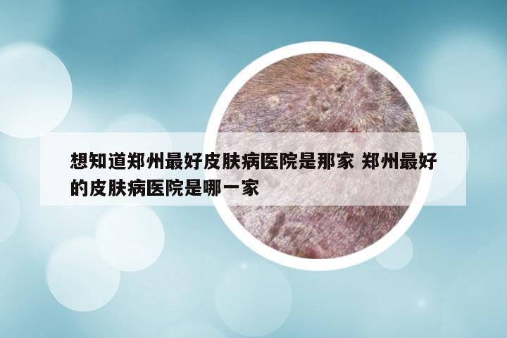 想知道郑州最好皮肤病医院是那家 郑州最好的皮肤病医院是哪一家
