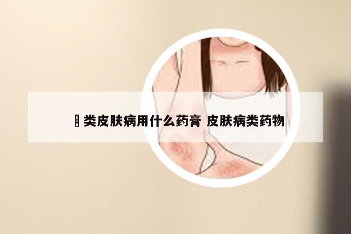 廯类皮肤病用什么药膏 皮肤病类药物