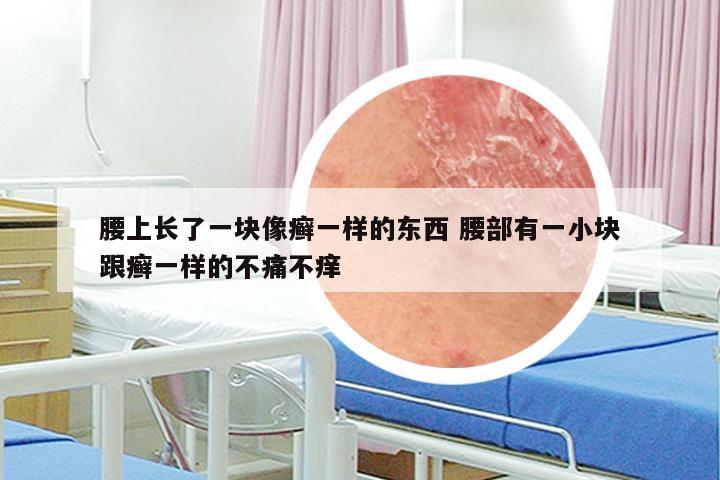 腰上长了一块像癣一样的东西 腰部有一小块跟癣一样的不痛不痒