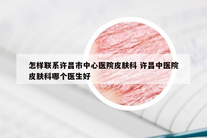 怎样联系许昌市中心医院皮肤科 许昌中医院皮肤科哪个医生好