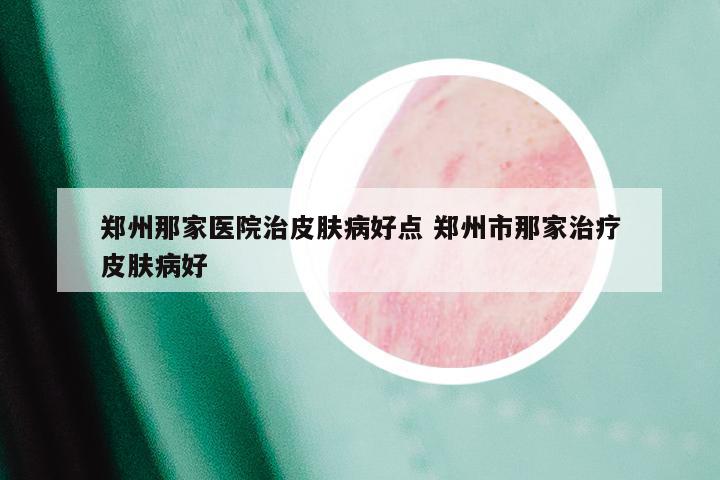 郑州那家医院治皮肤病好点 郑州市那家治疗皮肤病好