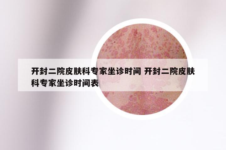 开封二院皮肤科专家坐诊时间 开封二院皮肤科专家坐诊时间表