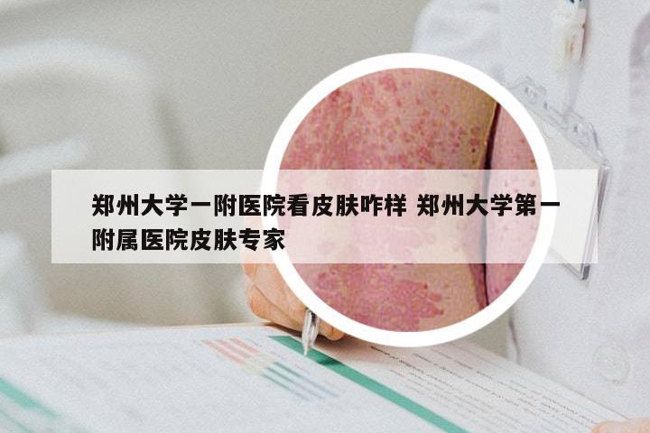 郑州大学一附医院看皮肤咋样 郑州大学第一附属医院皮肤专家