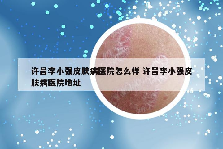 许昌李小强皮肤病医院怎么样 许昌李小强皮肤病医院地址