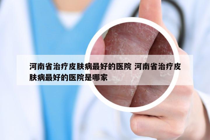河南省治疗皮肤病最好的医院 河南省治疗皮肤病最好的医院是哪家