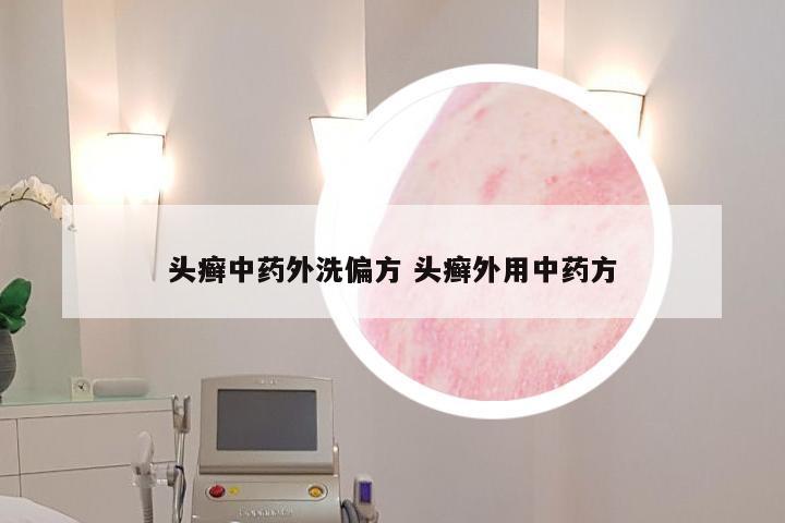 头癣中药外洗偏方 头癣外用中药方