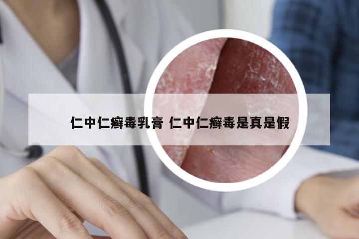 仁中仁癣毒乳膏 仁中仁癣毒是真是假