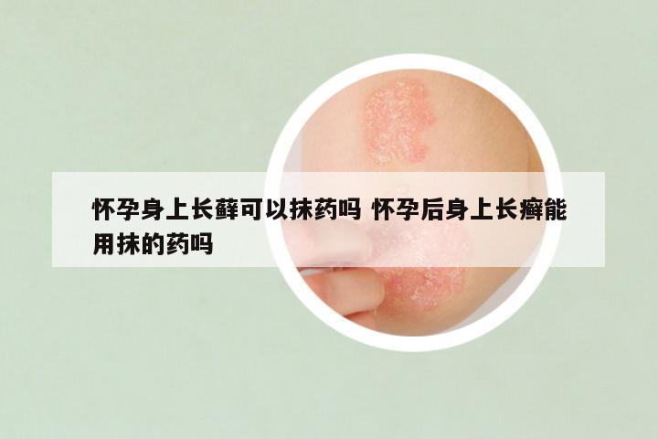 怀孕身上长藓可以抹药吗 怀孕后身上长癣能用抹的药吗