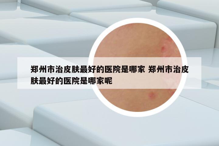 郑州市治皮肤最好的医院是哪家 郑州市治皮肤最好的医院是哪家呢