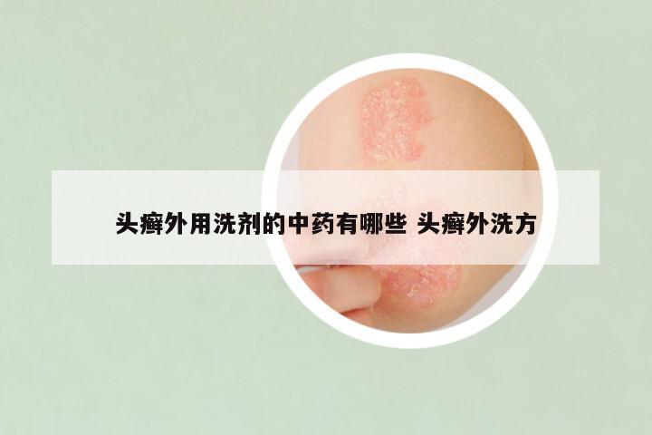 头癣外用洗剂的中药有哪些 头癣外洗方